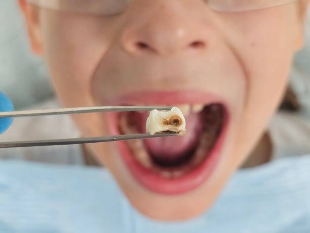 Best Emergency Treatment for Toothache in Lake Village, AR